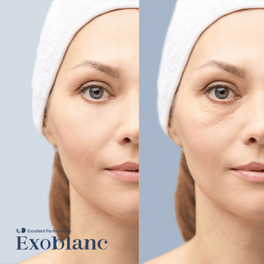 NMN Eye Cream