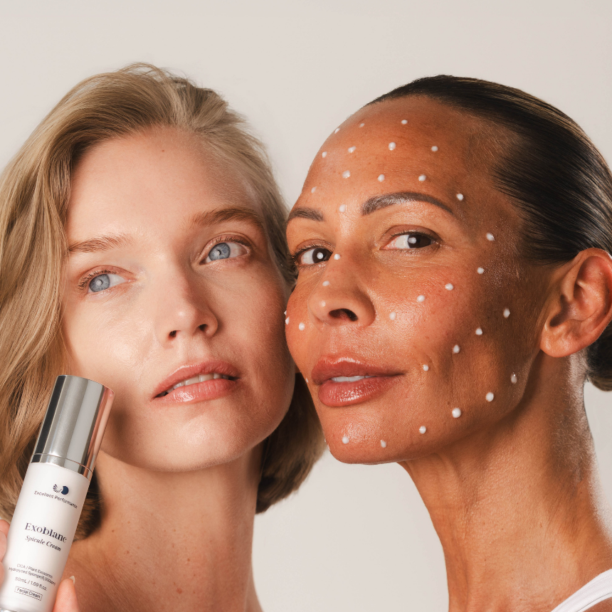 Fine lines & wrinkles