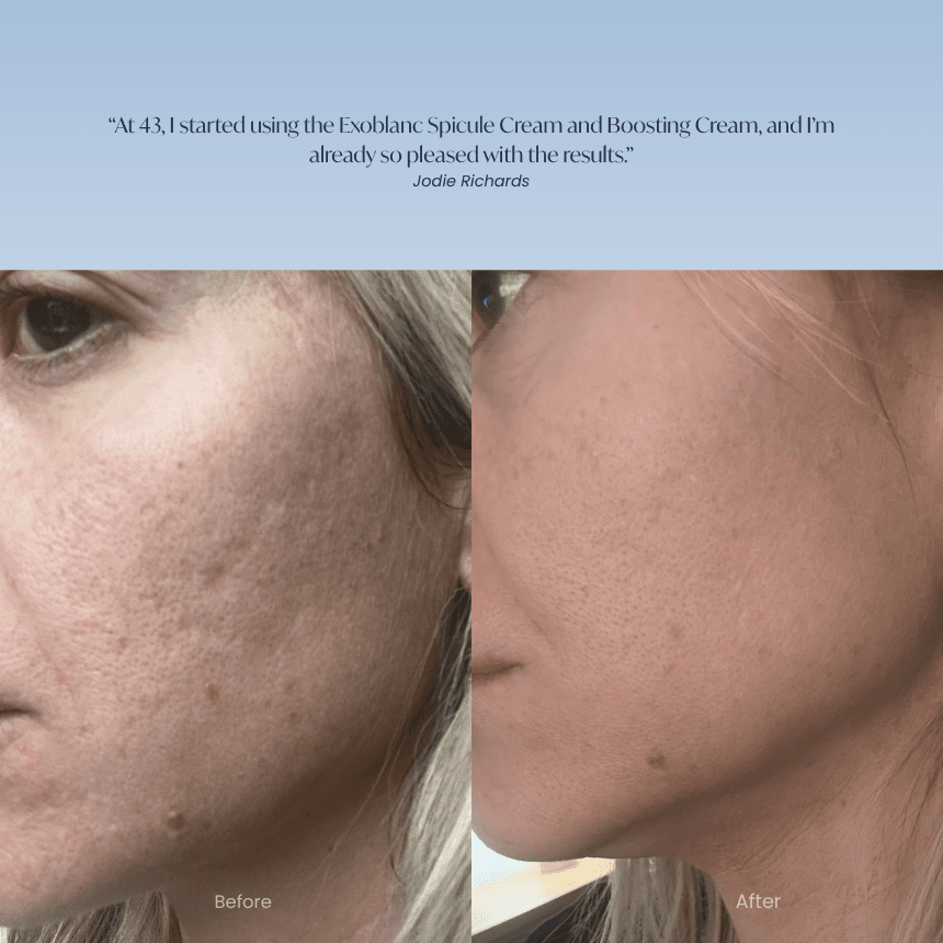 Liquid Microneedling Spicule Cream