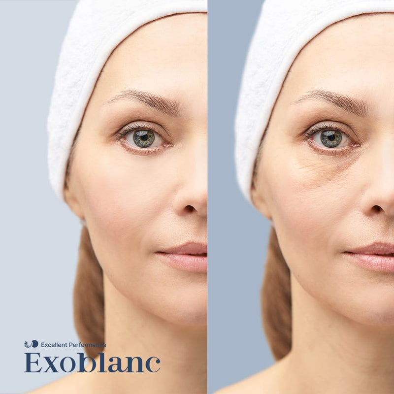 Advanced Eye Zone Care