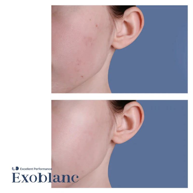 Why Choose Spicule Cream?			